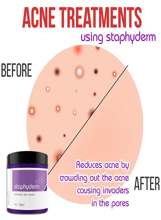 OmNutra Staphyderm Non Antibiotic Ointment - 4OZ All Natural Topical Probiotic Lotion New Skin Therapy Cream For Dry Itchy Skin Organic Based Topical Probiotics for Skin Care - Image 4